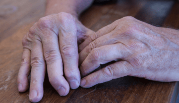 Psoriatic Arthritis (PSA)